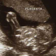 le placenta