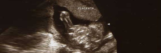 le placenta