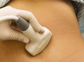 la stimulation ovarienne