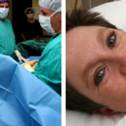 cesarienne et anesthesie