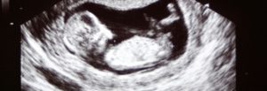 échographie morphologique du deuxième trimestre de grossesse
