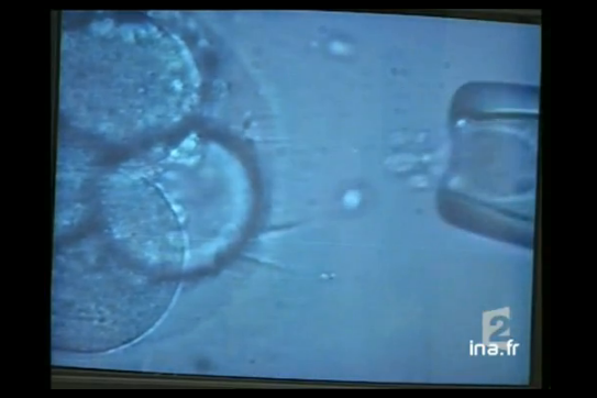 Naissance d&rsquo;un bébé par maturation in vitro