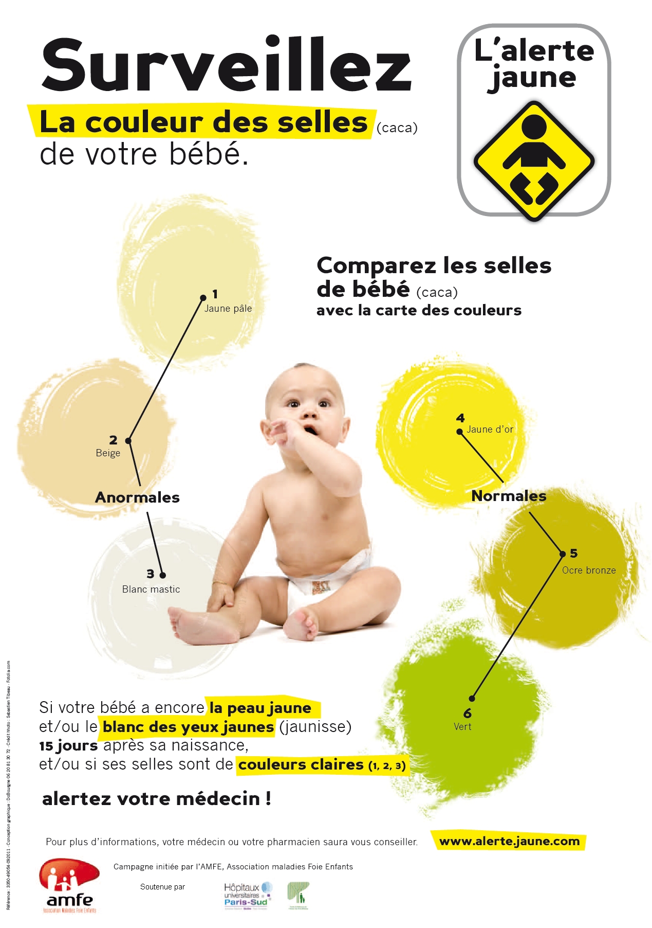 Surveillez la couleur des selles de votre bébé